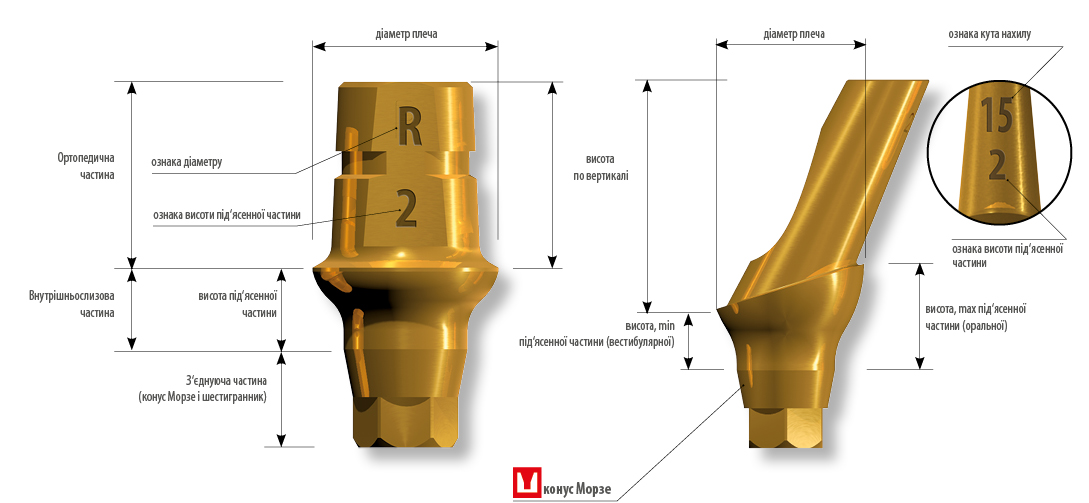 STAR Abutments